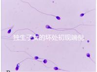 獨生子女的壞處初現端倪,贍養父母已成難題