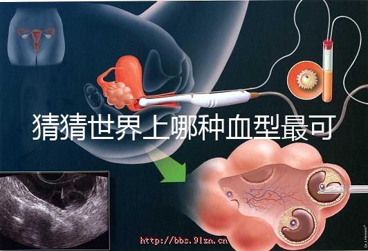 猜猜世界上哪種血型最可怕，史上超全排行榜為你揭曉答案