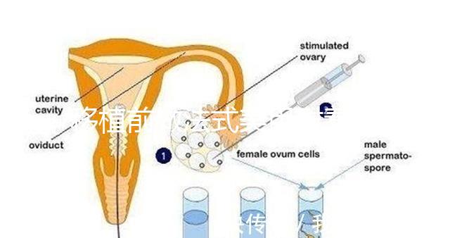 移植前做法式美甲對(duì)著床影響不少，別以為貼甲片就沒事了