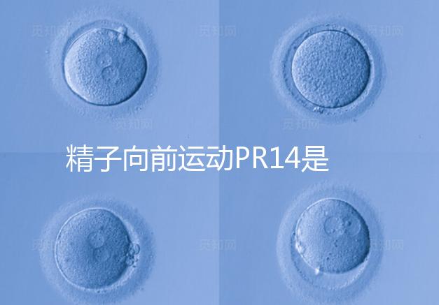 精子向前運(yùn)動(dòng)PR14是否正常聽專家怎么說，當(dāng)心弱精找上門