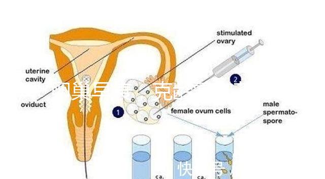 卵巢早衰，克齡蒙和芬嗎通藥物選擇引爭議