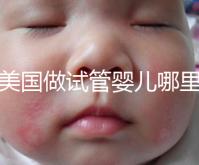 去美國做試管嬰兒哪里最好,4家好評輔助生殖機(jī)構(gòu)推薦