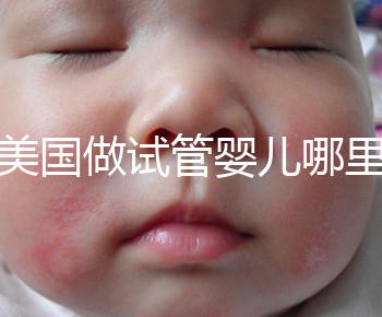 去美國做試管嬰兒哪里最好，4家好評輔助生殖機構推薦