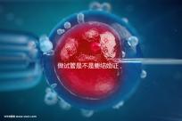 做試管是不是要結婚證，做試管需要結婚證