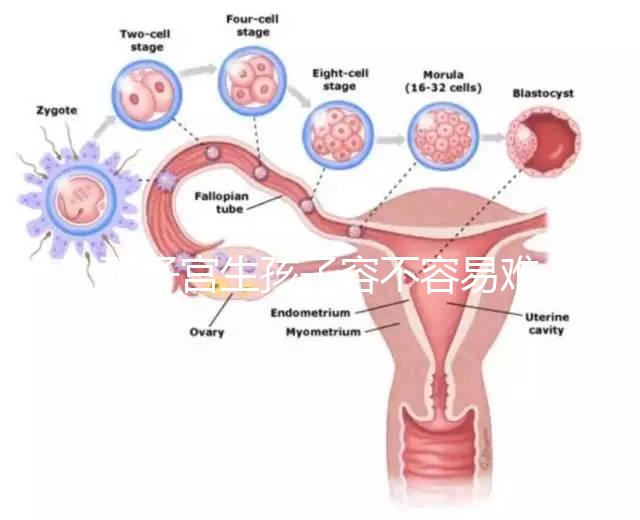 雙子宮生孩子容不容易難產看情況，注意這幾點也能順利抱娃