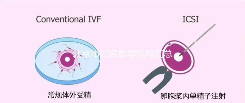 北京市知名助孕機(jī)構(gòu)匯總,成功率多少一看便知!