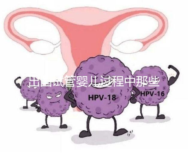 出國(guó)試管嬰兒過(guò)程中那些困惑,12個(gè)常見問題釋疑