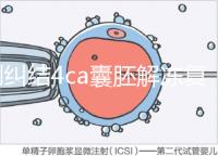別糾結4ca囊胚解凍復蘇最早幾天能測出了，著床率先了解下