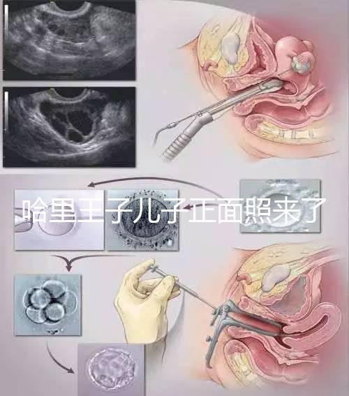 哈里王子兒子正面照來了,梅根評價:氣質(zhì)甜美,乖巧