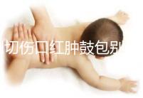 側切傷口紅腫鼓包別擔心，分階段和步驟教你護理