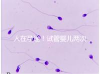 人在孕途!試管嬰兒兩次胎停育,了解這幾招能降低流產(chǎn)風(fēng)險