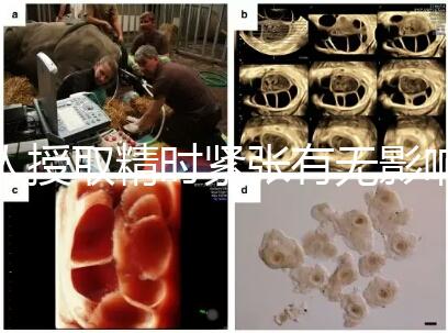 人授取精時緊張有無影響別還不造,注意事項不少不可不知