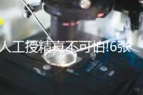 人工授精真不可怕!6張過程圖,讓你更快了解真正的人授