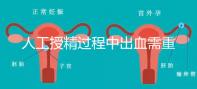 人工授精過(guò)程中出血需重視!這3種情況會(huì)影響成功率