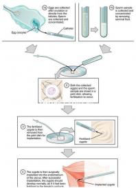 事后24h或72h吃避孕藥有效率真不高，一不小心容易中招