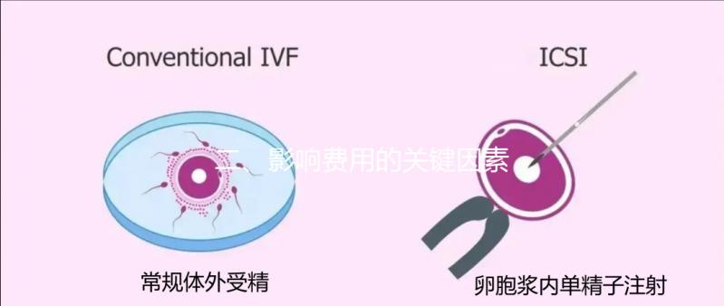 二、影響費用的關鍵因素