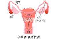 產后喝生化湯排惡露會使寶寶拉肚子?醫生:時間沒用對
