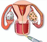 為什么不建議12月齡寶寶打水痘疫苗,醫(yī)生道出其中端倪