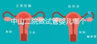 中山二院做試管嬰兒哪個(gè)醫(yī)生好？附醫(yī)院試管成功率
