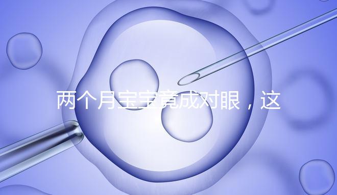 兩個月寶寶竟成對眼，這5大形成原因家長必知