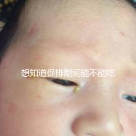 想知道促排期間能不能吃草莓看過來，怎么吃不發胖有講究