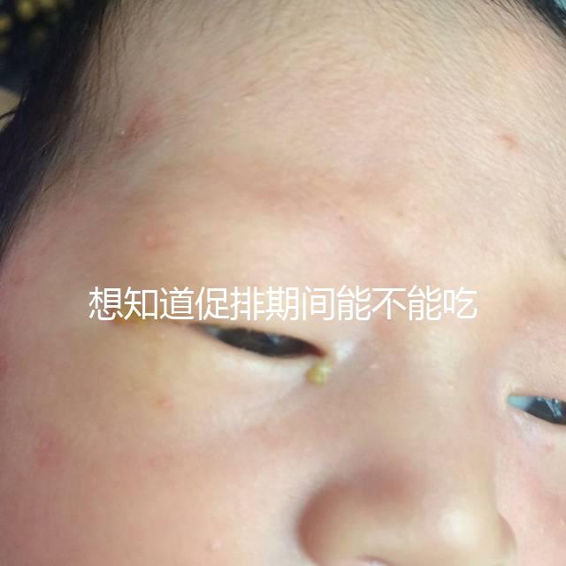 想知道促排期間能不能吃草莓看過來,怎么吃不發(fā)胖有講究