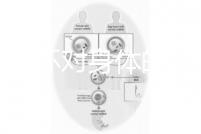 揭秘上環對身體的5大壞處,女人別再無知了