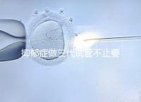 抑郁癥做三代試管不止要基因檢測，這兩大條件也得滿足