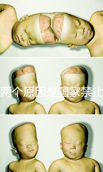 有兩個原因是國家禁止中非混血中國會接受嗎？