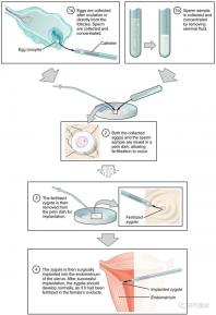 武漢四維彩超費(fèi)用表整理,內(nèi)附市婦保院超全預(yù)約攻略