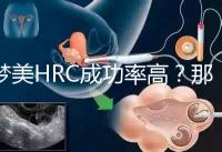夢美HRC成功率高？那是因為有這些試管嬰兒醫生