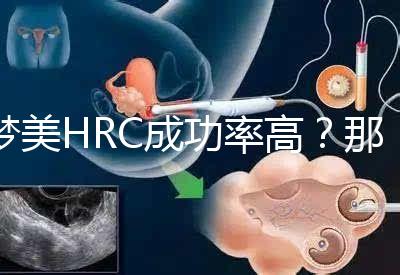 夢美HRC成功率高？那是因為有這些試管嬰兒醫生