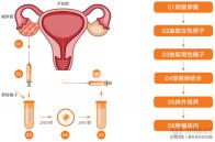 浙江生育登記在男方還是女方辦理,何時辦理全面分析,快速收集