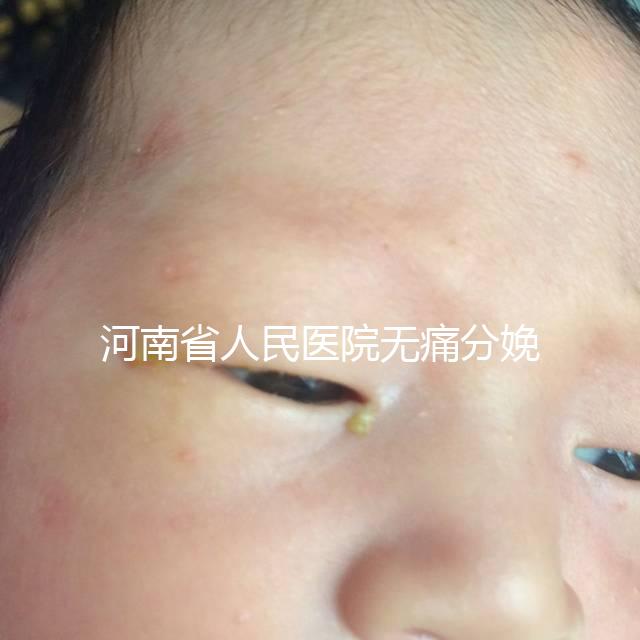 河南省人民醫(yī)院無痛分娩多少錢戳,收費(fèi)標(biāo)準(zhǔn)60s看懂不踩坑