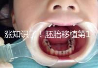 漲知識了！胚胎移植第12天出血不見得是試管失敗