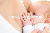 子宮縱隔手術(shù)后別太早要孩子,多久可以懷孕有時間要求!