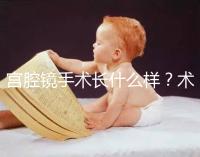 宮腔鏡手術(shù)長什么樣?術(shù)后要注意什么? ?