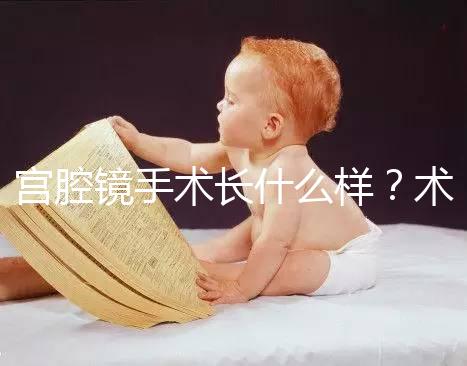 宮腔鏡手術(shù)長什么樣？術(shù)后要注意什么？ ?