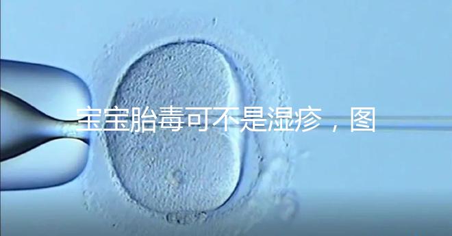 寶寶胎毒可不是濕疹,圖文解讀兩者詳細區別