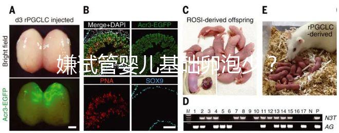 嫌試管嬰兒基礎卵泡少？并非只能食療，這份增多錦囊請收下