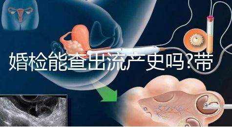 婚檢能查出流產(chǎn)史嗎?帶你詳細(xì)解答相關(guān)疑惑