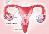 小孩發(fā)燒抽搐原因有3點,急救很關(guān)鍵!