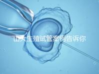 山大生殖試管案例告訴你,歷經(jīng)3個(gè)月后懷孕辛酸史