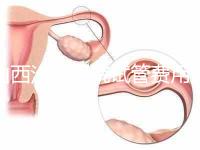 山西汾陽醫(yī)院試管費用清單公布,2024年生殖科助孕成功率公布