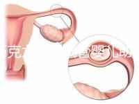 巧克力囊腫試管嬰兒助孕應先治療?網友看法均有差異