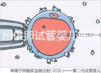 廣州供卵試管嬰兒醫(yī)院匯總,真實(shí)案例告訴你廣東哪家最好