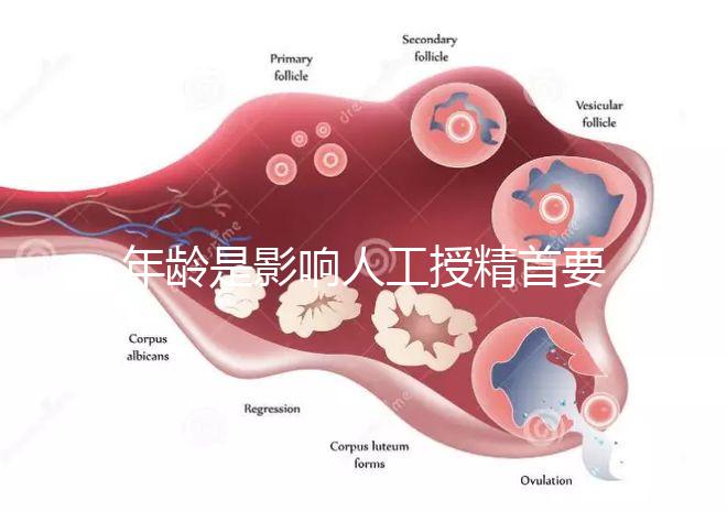 年齡是影響人工授精首要因素之一,你還做丁克一族嗎?
