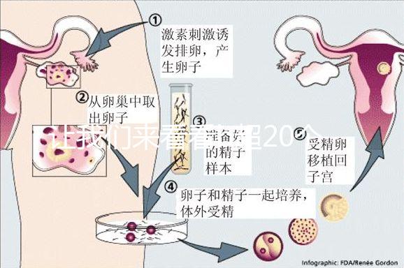 讓我們來看看b超20個卵子取10個是不正常的我們該怎么辦？