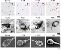 補(bǔ)充葉酸?elevit愛樂維那你不得不了解