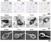試管促排卵不同方案都適合哪些人？如何監測排卵？